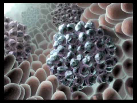 Видео о препарате Гливек 400 мг табл. п/о №30